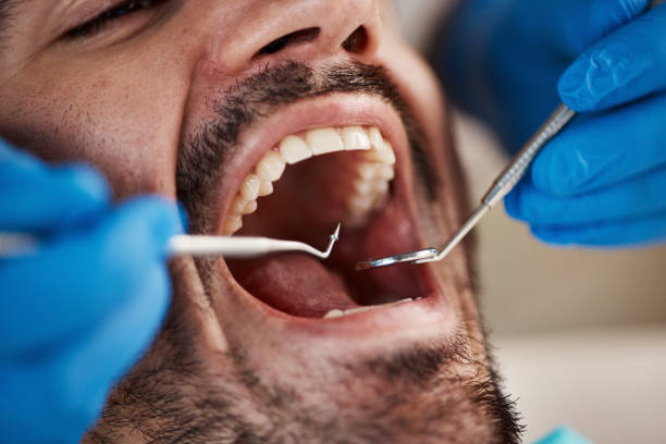 Best Broken or Chipped Tooth Repair in Middle Island, NY