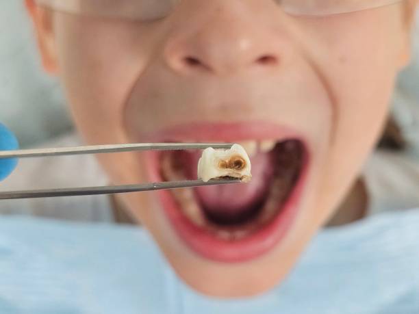 Best Emergency Care for Gum Disease in Middle Island, NY